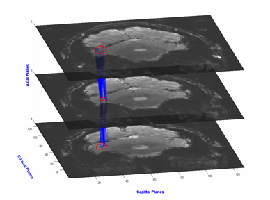 locating the fusiform face area